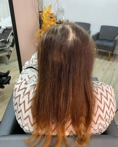 Antes