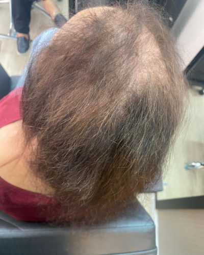 Antes