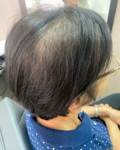 Antes