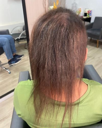 Antes